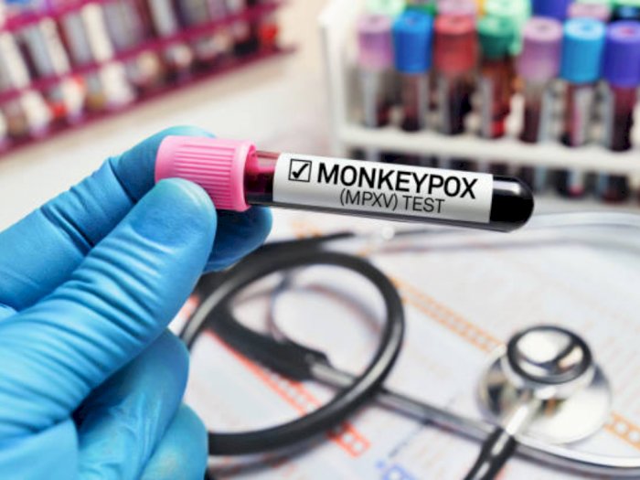 Peneliti Korsel Kembangkan Alat Tes PCR Khusus Cacar Monyet Hasil Keluar dalam 90 Menit