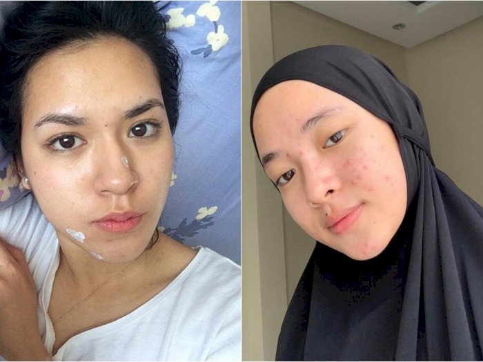 Selain Tara Basro Deretan Artis Ini Juga Tetap Cantik Meski Tampil Tanpa Makeup Kwikku 9896