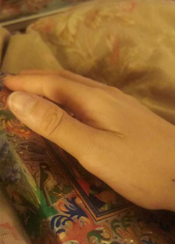 Plesternya sewarna kulit Kwikku, Plesternya sewarna kulit