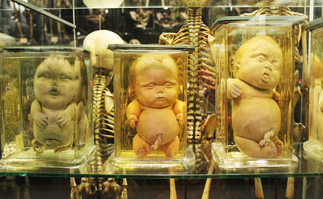 Museum Vrolik Kwikku, Museum Vrolik