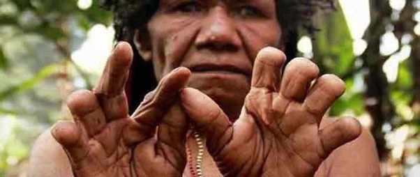 Memotong Jari Tangan Kwikku, Memotong Jari Tangan