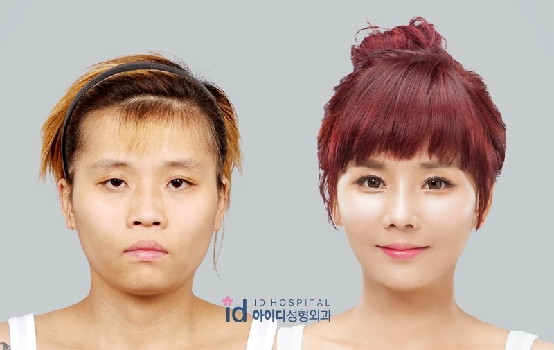 Soyoung Bae Kwikku, Soyoung Bae
