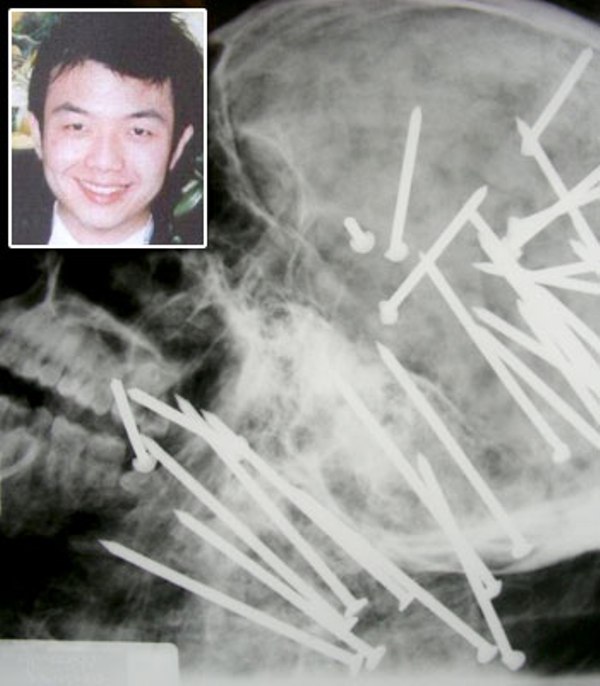 Bagian kepala seorang lelaki di Cina bernama Chen Liu Kwikku, Bagian kepala seorang lelaki di Cina bernama Chen Liu