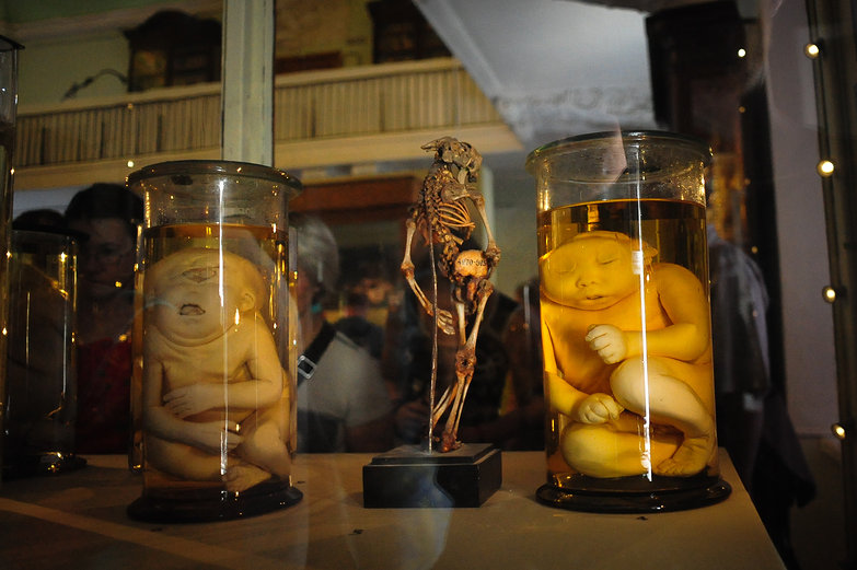 Koleksi Freaks oleh Frederik Ruysch Kwikku, Koleksi Freaks oleh Frederik Ruysch