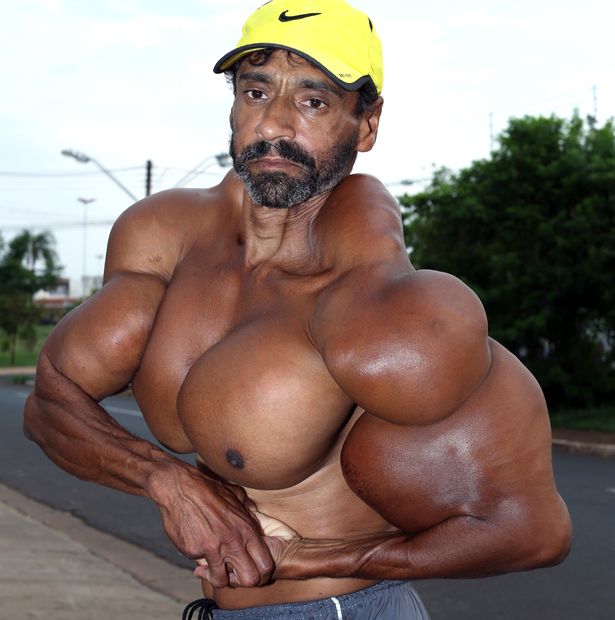 Suntik Synthol Kwikku, Suntik Synthol
