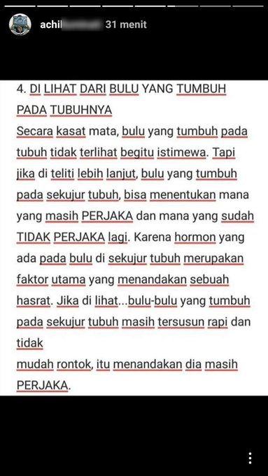 Setelah itu ciriciri yang selanjutnya yaitu terletak pada bulubulu yang tumbuh pada tubuh Kalian bisa membedakannya dengan mudah dari sini Kwikku, Setelah itu ciriciri yang selanjutnya yaitu terletak pada bulubulu yang tumbuh pada tubuh Kalian bisa membedakannya dengan mudah dari sini