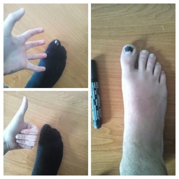 Supaya kaos kaki bolong masih di bisa di gunakan secara normal Kwikku, Supaya kaos kaki bolong masih di bisa di gunakan secara normal
