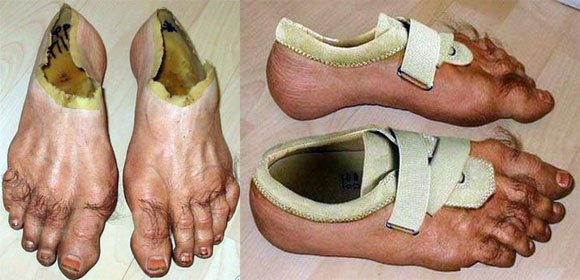 Mungkin orang yang buat itu sukanya nyeker tapi pengen pake sepatu secara bersamaan Kwikku, Mungkin orang yang buat itu sukanya nyeker tapi pengen pake sepatu secara bersamaan